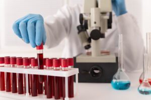 MCV Blood Test